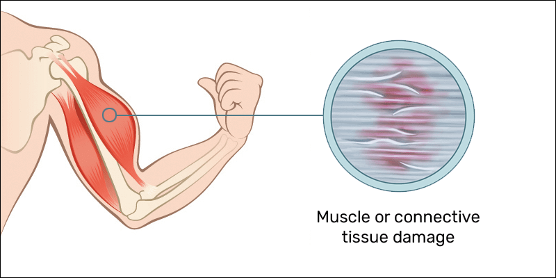 muscle soreness to touch