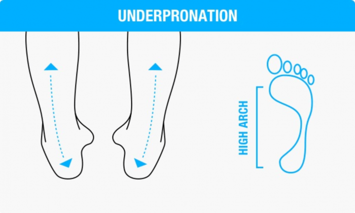 underpronation