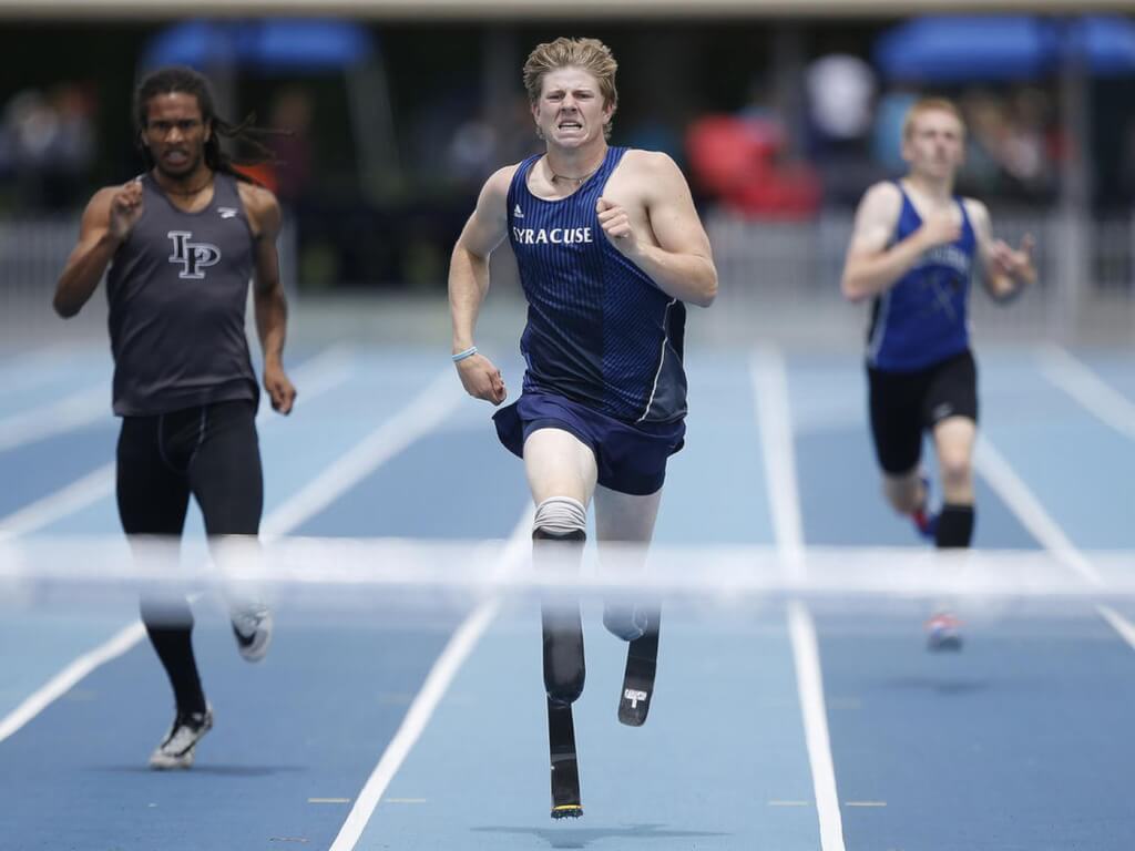 How a Prosthetic Running Leg Lets You Run An Ultra Marathon RC