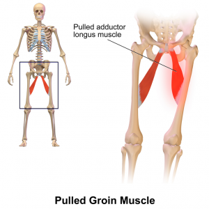 Groin Pain After Running: Causes & Quick Solutions | RunnerClick