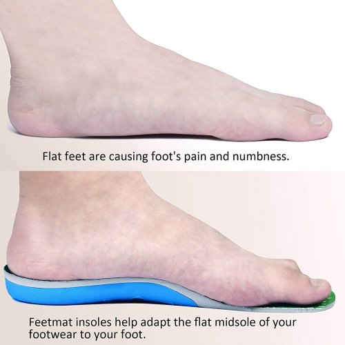 Feetmat insoles