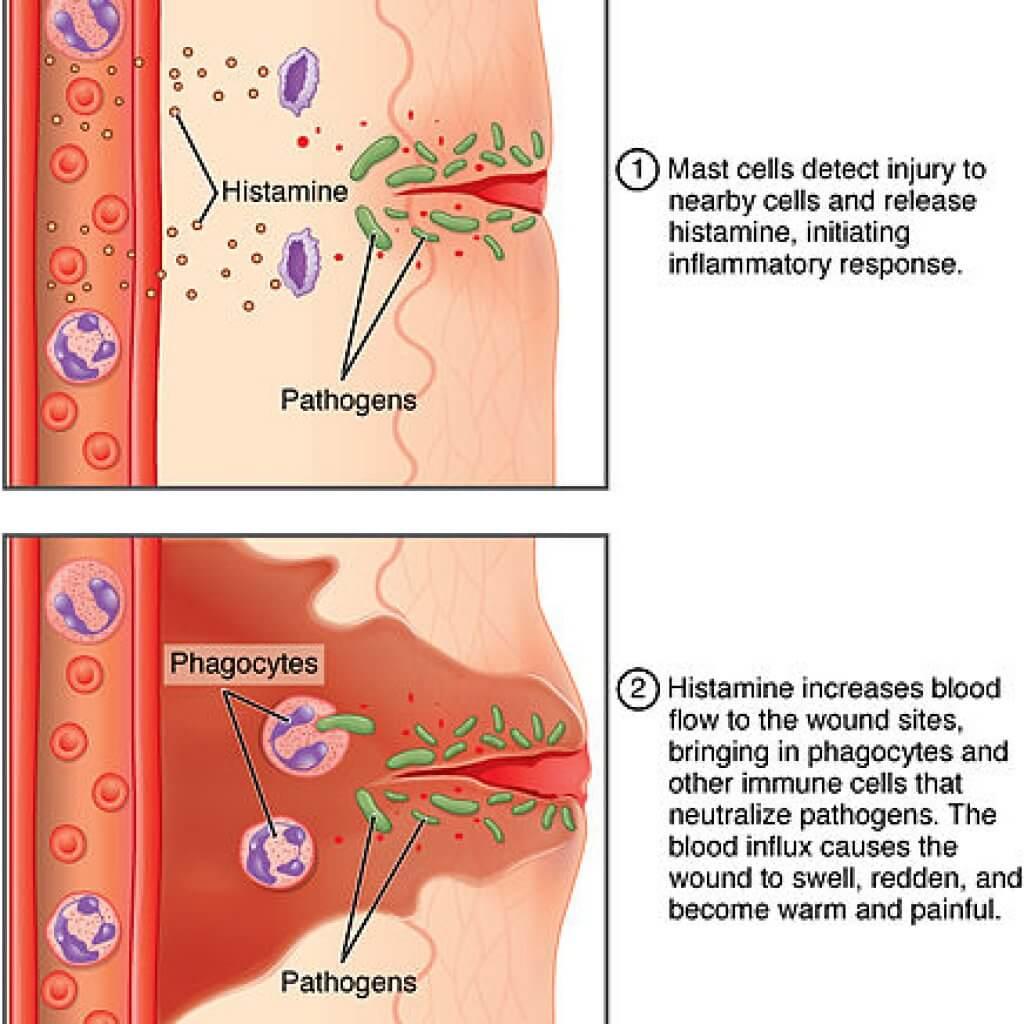 Inflammation-what-exactly-is-inflammation-best-anti-inflammatory-foods