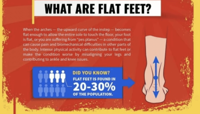 what are flat feet