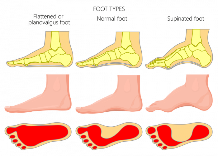 flat feet and zero drop shoes