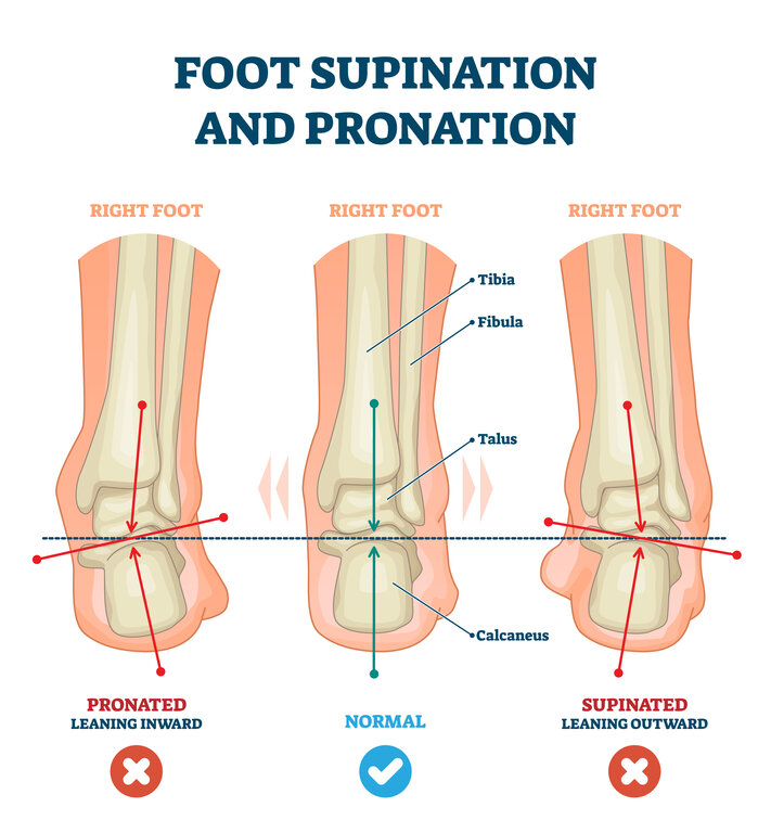 Foot pronation